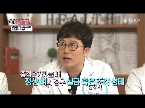 골다공증, 어릴 때부터도 생길 수 있다?! [닥터 스마일] 10회 20170905