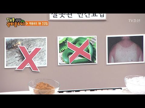 우리가 잘못 알고 있던 민간요법! [정보통 광화문 640] 47회 20170905