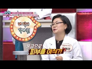 화상 환자를 위해 의사의 피부를 이식?! [모란봉 클럽] 103회 20170905