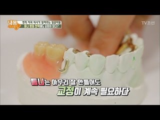 틀니는 무조건 동네 병원으로?! 그 이유는? [내 몸 사용설명서] 173회 20171007