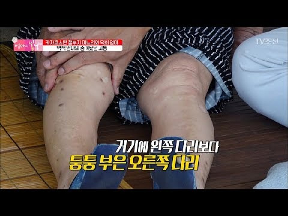 어머니의 숨겨왔던 고통...심각한 다리 상태 [엄마의 봄날] 110회 20171015