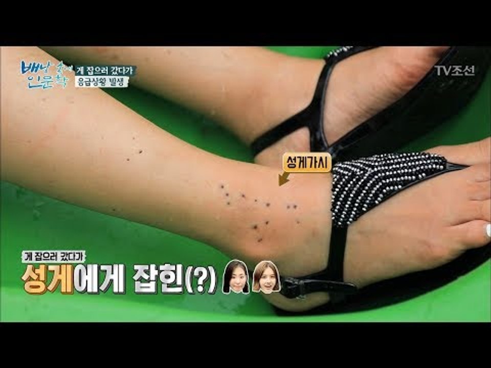 응급상황! 성게 가시에 찔린 박은지! [배낭 속에 인문학] 19회 20171017