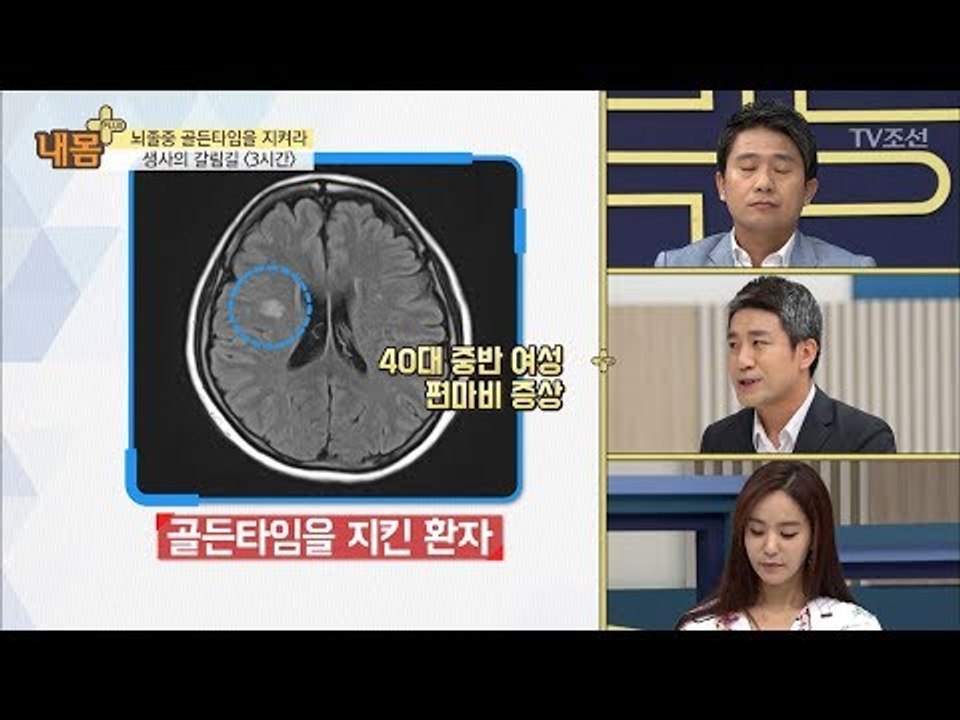 치료 가능한 뇌경색, 골든타임 3시간을 지켜라! [내 몸 플러스] 77회 20171022