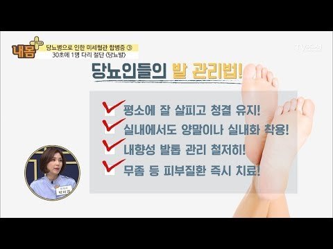 ‘당뇨발’을 예방하는 발 관리법! [내 몸 플러스] 79회 20171112