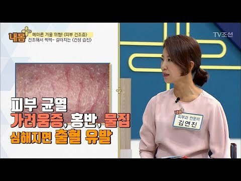 메마른 겨울, ‘피부 건조증’ 주의보! [내 몸 플러스] 84회 20171217