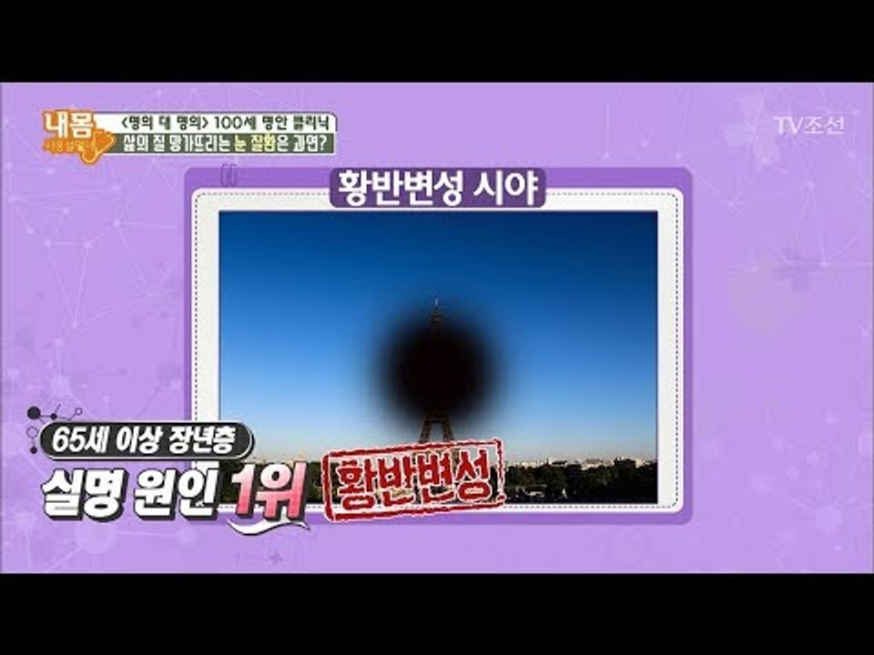 삶의 질을 망가뜨리는 눈 질환들 [내 몸 사용설명서] 182회 20171208