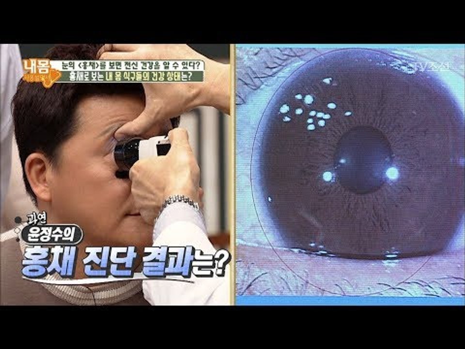 홍채로 본 윤정수의 건강 상태! 역류성 식도염이? [내 몸 사용설명서] 182회 20...