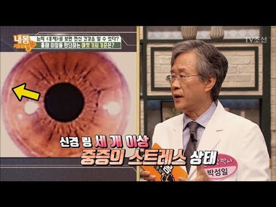 눈의 ‘홍채’를 보면 전신건강을 알 수 있다? [내 몸 사용설명서] 182회 2017...