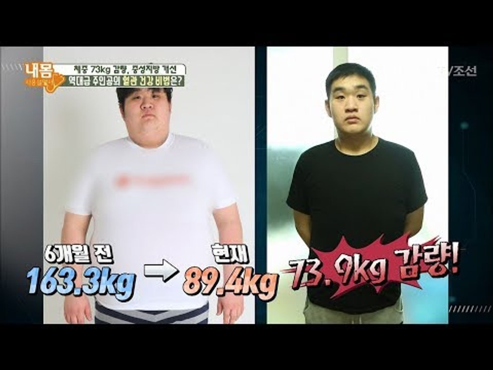 163kg 초고도 비만, 체중 73kg 감량 비법은? [내 몸 사용설명서] 183회...