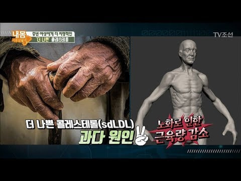 중년 ‘여성’에게 더 치명적인 ‘더 나쁜’ 콜레스테롤, 그 이유는? [내 몸 사용설명...