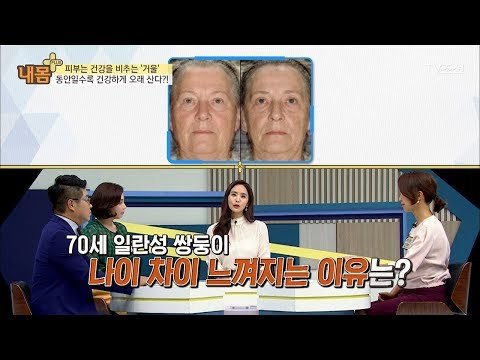 동안일수록 건강하게 오래 산다?! [내 몸 플러스] 84회 20171217