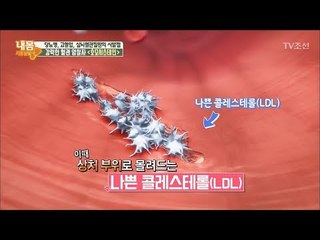 강력한 혈관 암살자 ‘호모시스테인’ [내 몸 사용설명서] 185회 20171229