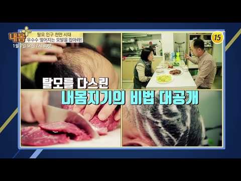 우수수 떨어지는 모발을 잡아라!_내 몸 플러스 86회 예고