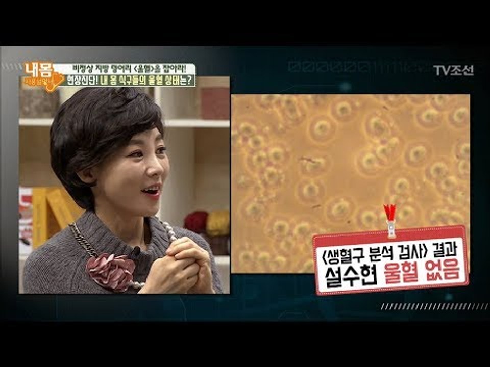 내 몸 식구들의 울혈 검사! 과연 결과는? [내 몸 사용설명서] 186회 20180105