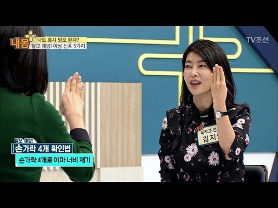모발이 보내는 ‘탈모’ 이상 신호들 [내 몸 플러스] 86회 20180107