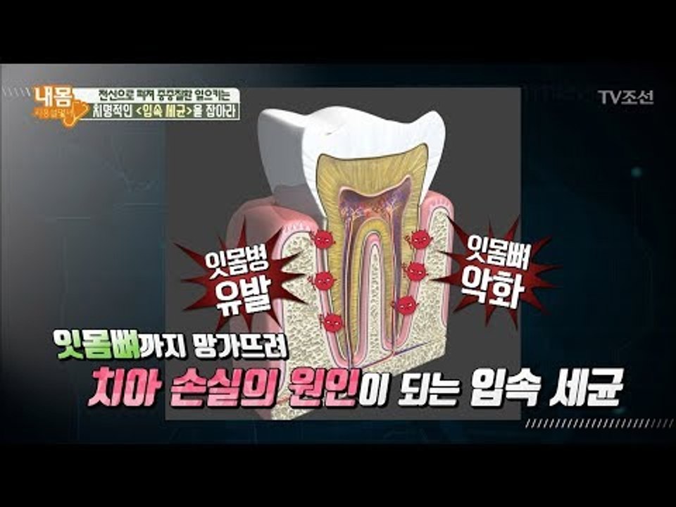 암, 치매는 입속에서 시작된다?! [내 몸 사용설명서] 187회 20180112