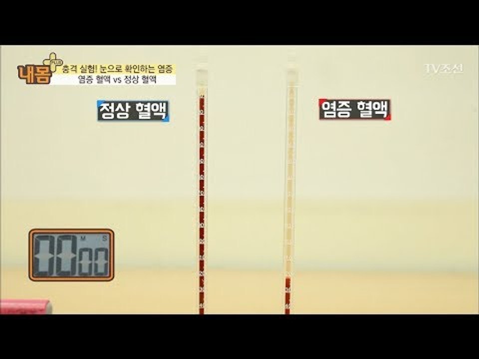 정상 혈액 vs 염증 혈액, 어떻게 다를까? [내 몸 플러스] 87회 20180114