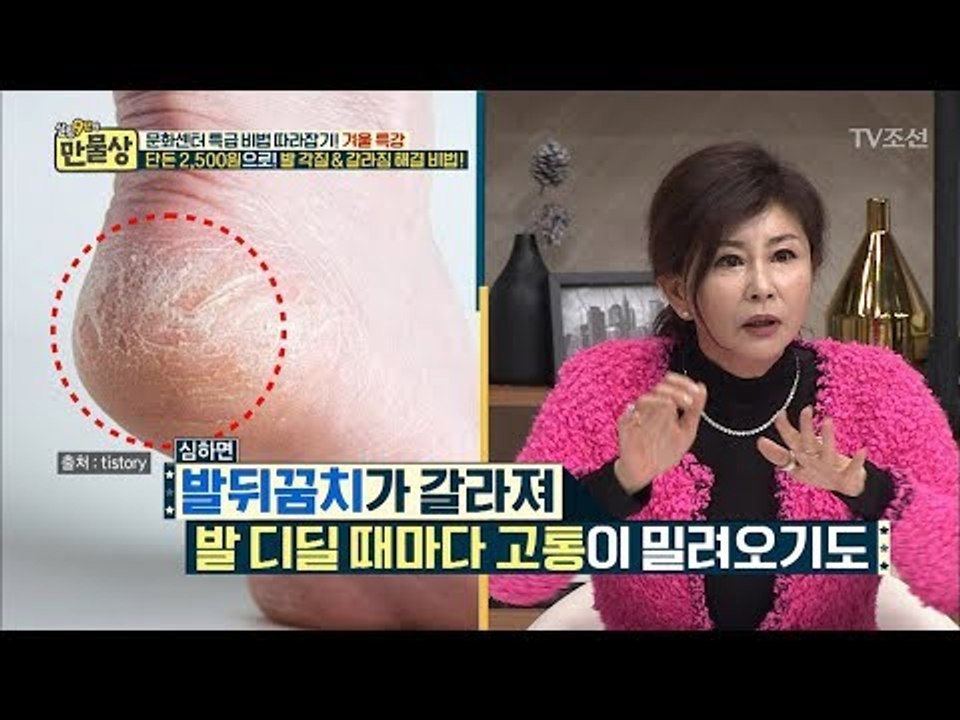 겨울철, 건조한 발뒤꿈치를 잡아줄 뷰티강사의 꿀팁! [만물상 228회] 20180118