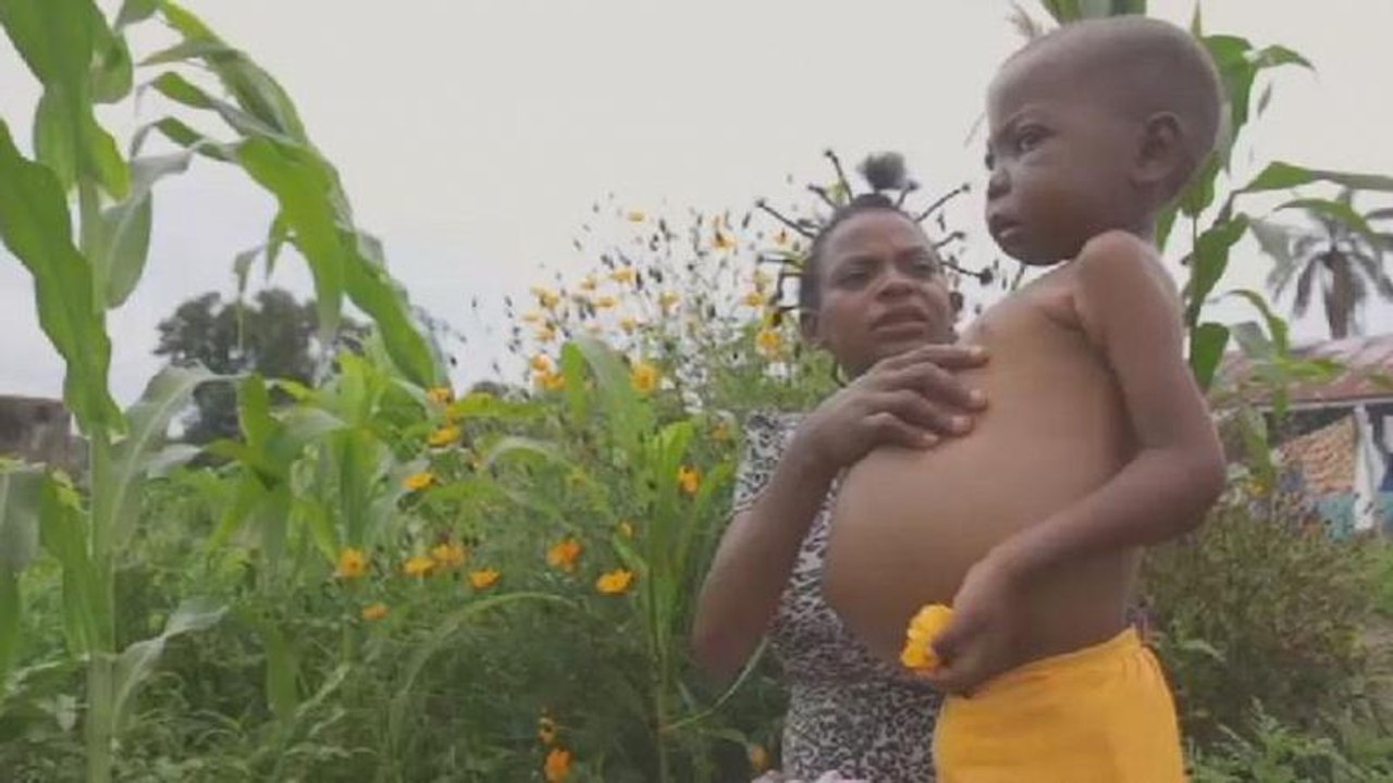 DRC: 260,000 children severely malnourished- UNICEF