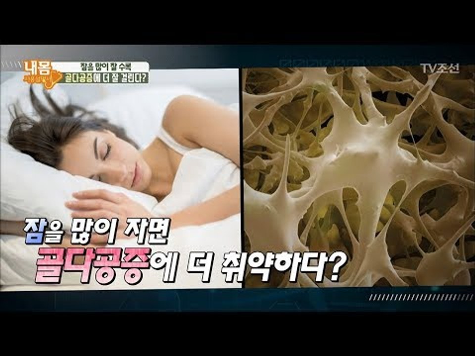 잠을 많이 잘수록 ‘골다공증’에 더 잘 걸린다? [내 몸 사용설명서] 191회 201...