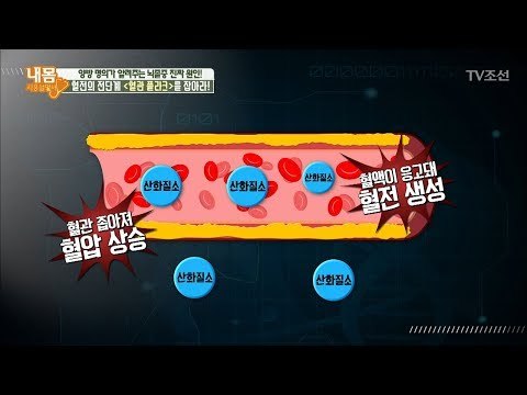 각종 혈관질환의 원인인 혈관 플라크! [내 몸 사용설명서] 193회 20180223