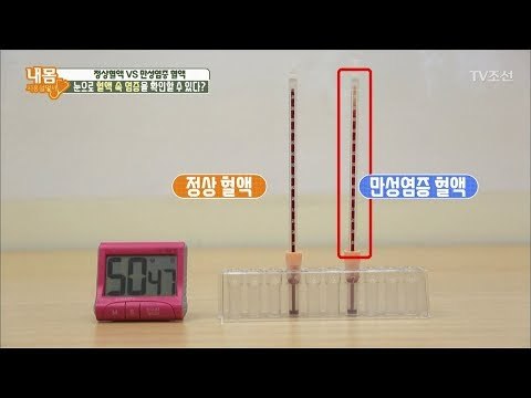 눈으로 혈액 속 염증을 확인할 수 있다?! [내 몸 사용설명서] 196회 20180316