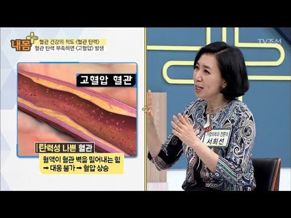 혈관 탄력이 떨어지면 고혈압 발생?! [내 몸 플러스] 100회 20180506