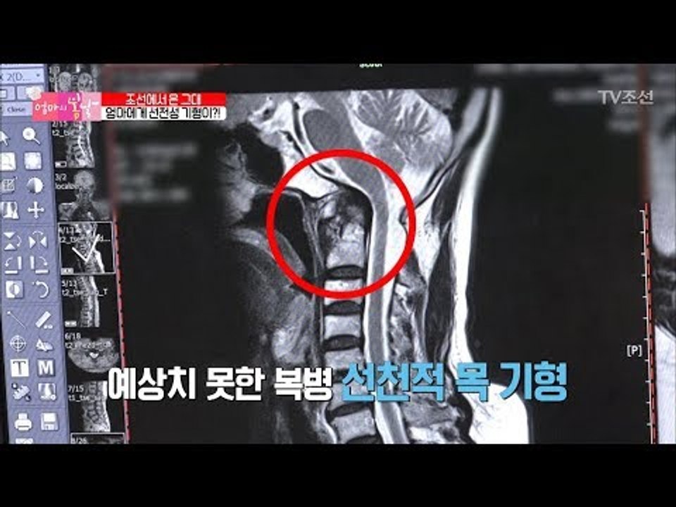 [충격] 70년 만에 알게 된 금숙 엄마의 기형 [엄마의 봄날] 138회 20180506