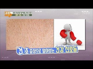 피부 건조의 경고등은 ‘이것’이다! [내 몸 사용설명서] 202회 20180428