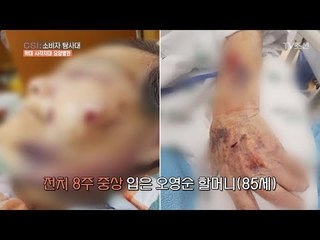 끊이지 않는 요양병원 학대 사건! [CSI 소비자 탐사대 22회] 20180429