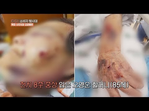 끊이지 않는 요양병원 학대 사건! [CSI 소비자 탐사대 22회] 20180429