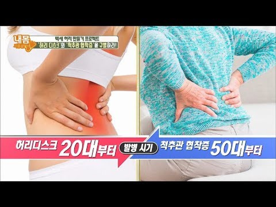 중장년층의 고질병! 허리 통증의 원인은? [내 몸 사용설명서] 203회 20180505