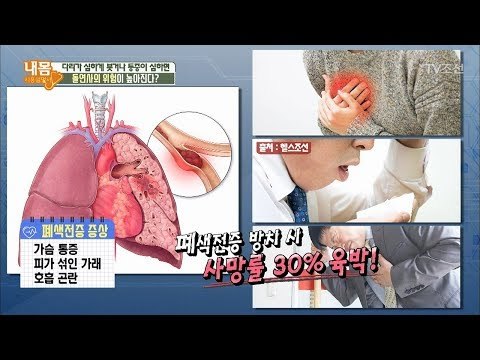 다리 통증과 붓기 방치하면 돌연사의 위험까지?! [내 몸 사용설명서] 210회 20180623