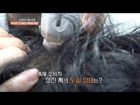 빠진 머리를 가리려다 머리가 더 빠진다?! [CSI 소비자 탐사대 25회] 20180520
