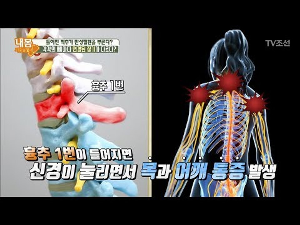 ‘이곳’ 눌러 아프다면?! 어깨, 목에 문제가?! [내 몸 사용설명서] 207회 20...