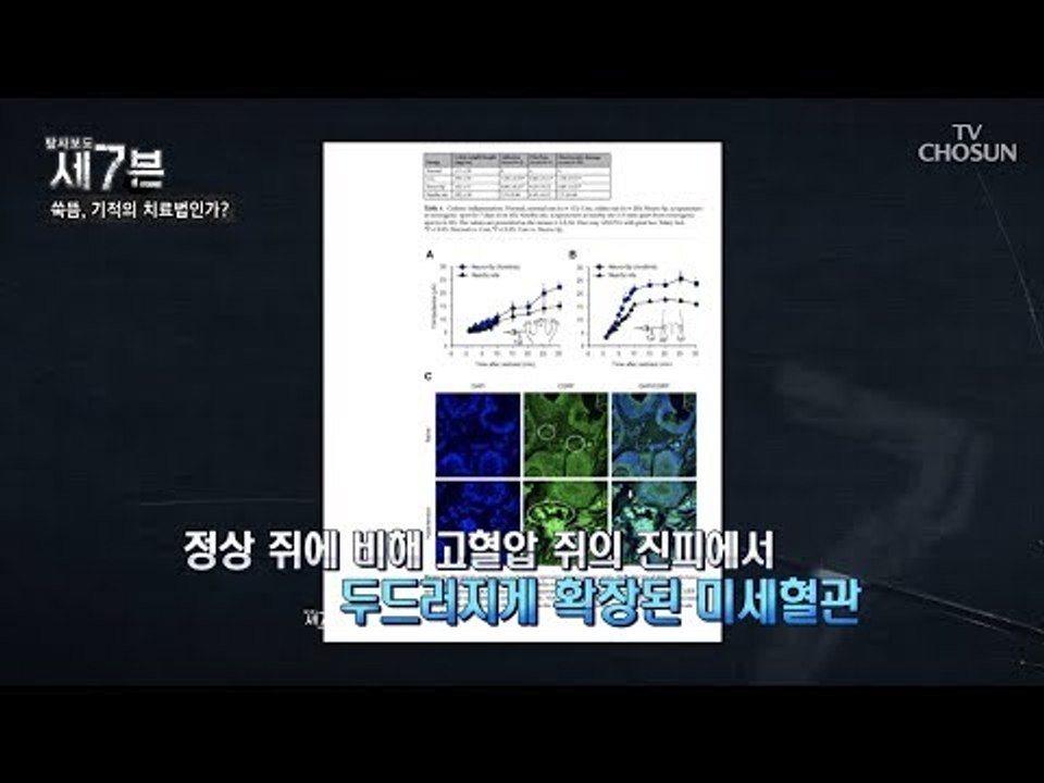 침과 뜸의 원리가 같아 모든 사람에게 도움이 된다?! [탐사보도 세븐 49회] 201...