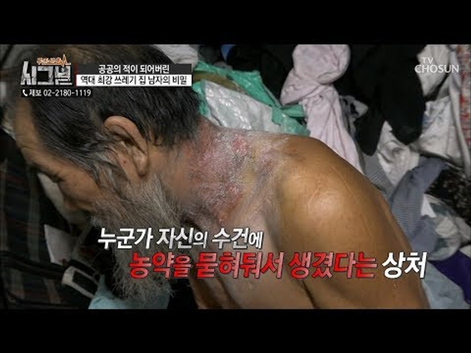 갑오징어뼈로 만든 비법약? 바르는 방법도 색다른 민간요법! [시그널] 43회 2018...