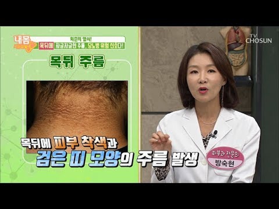 때가 아니라 건강 위기 신호?! 우리가 몰랐던 목 뒤 주름의 진실! [내 몸 사용설명...