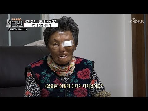 얼굴에 눈코입이 없다?! 한순간에 바뀌어버린 할머니의 삶! [시그널] 53회 20181205