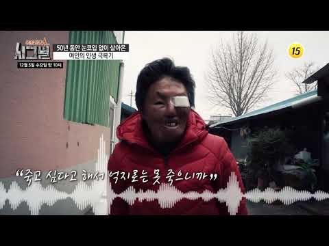 50년 동안 눈코입 없이 살아온 여인의 인생 극복기_시그널 53회 예고