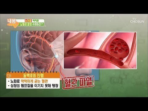 뇌동맥류 환자 15% 병원 도착 전 사망?! [내 몸 사용설명서] 236회 20190118