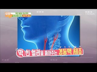 뇌혈관 질환 예방 하려면? 경동맥 체조! [내 몸 사용설명서] 236회 20190118