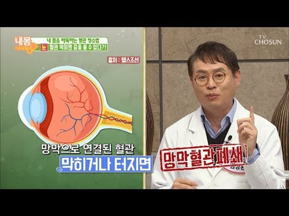 눈이 충혈되면 중풍 올 수 있다?! [내 몸 사용설명서] 236회 20190118