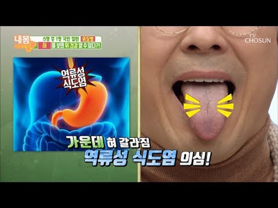혀와 위는 무슨 관계?! 혀로 보는 위 건강법 [내 몸 사용설명서] 238회 2019...