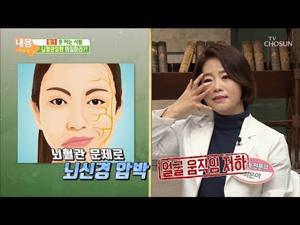 윙크 못 하는 사람의 정체는? 뇌혈관질환 의심! [내 몸 사용설명서] 236회 201...