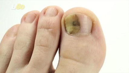 Here's Why Stubbed Toes and Paper Cuts Hurt So Bad