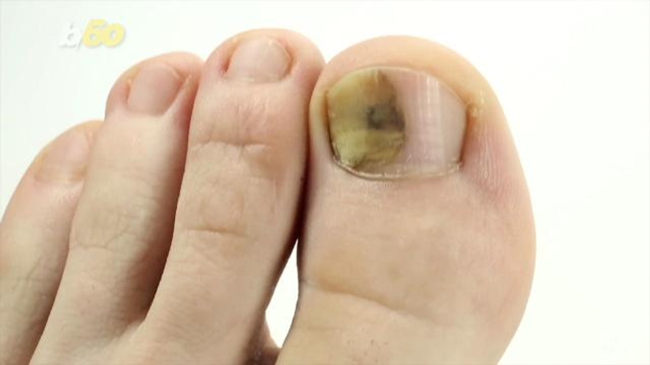 Here's Why Stubbed Toes and Paper Cuts Hurt So Bad