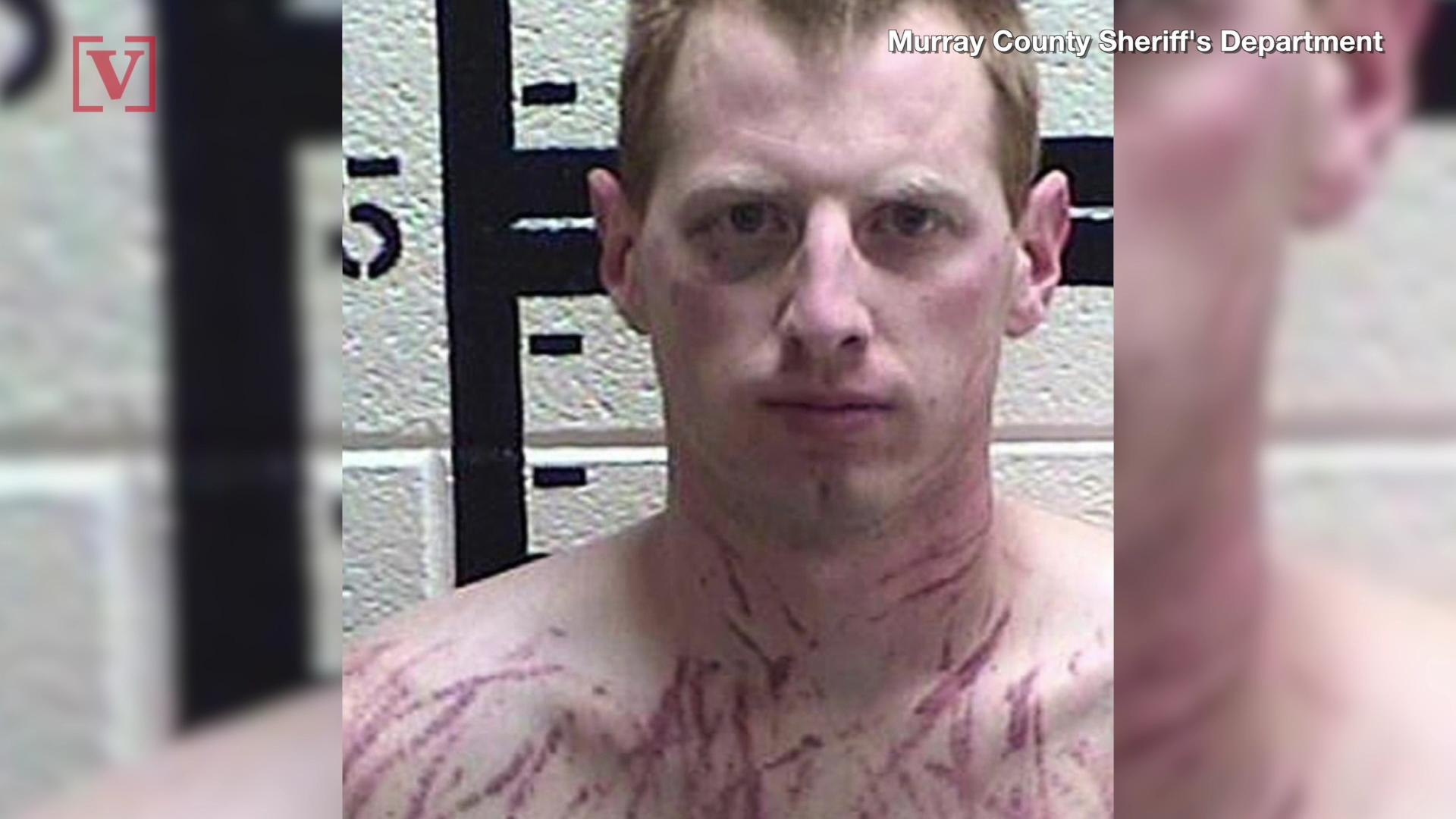 ⁣Former Corrections Officer Covered In Scratches After Allegedly Raping His Ex