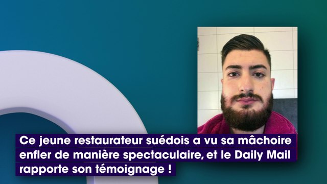 La tête d’un homme gonfle comme un ballon après une teinture pour barbe