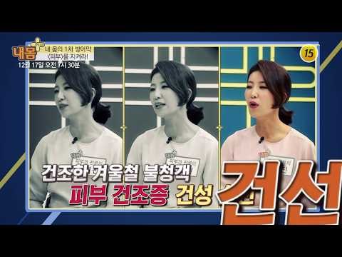 내 몸의 1차 방어막 〈피부〉를 지켜라!_내 몸 플러스 84회 예고